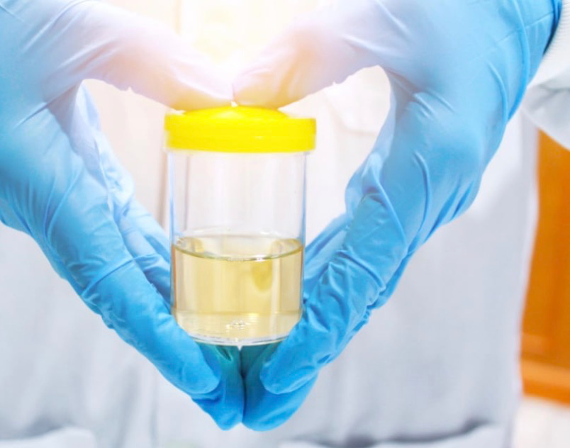 Urine Testing Collection